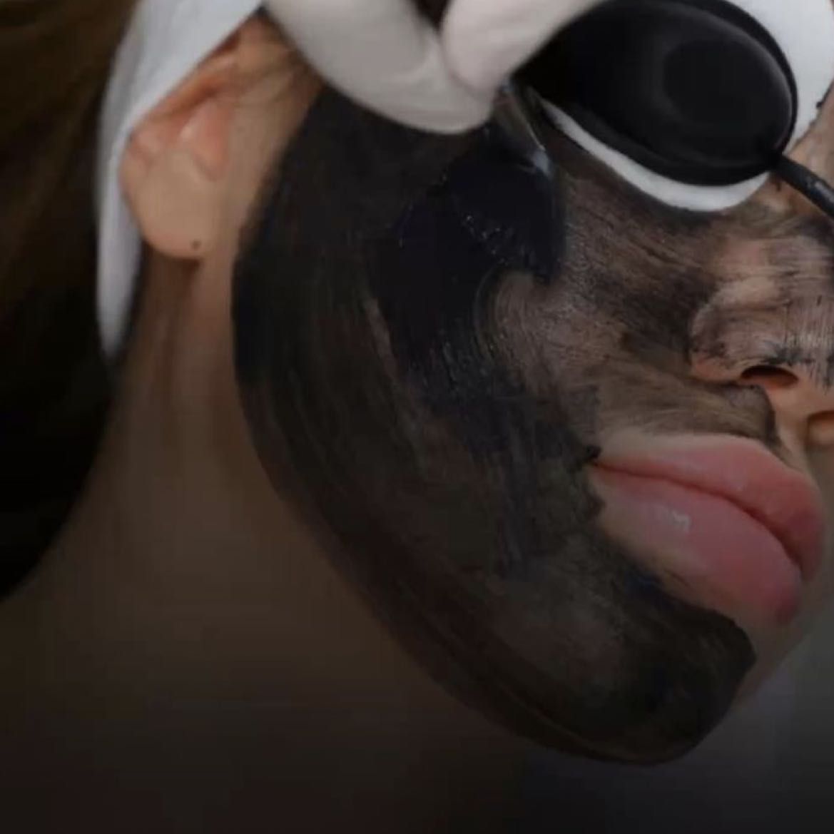 Carbon / węglowy peeling