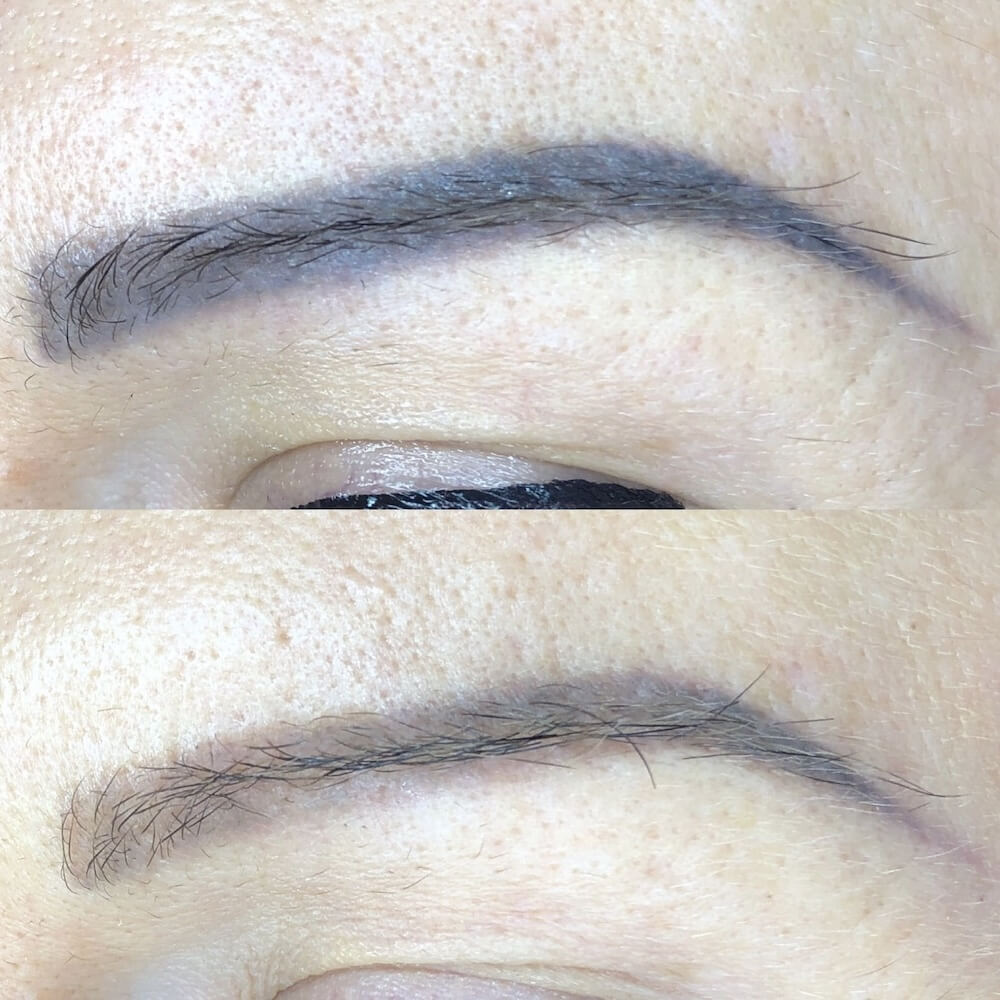 Laserowe usuwanie makijażu permanentnego