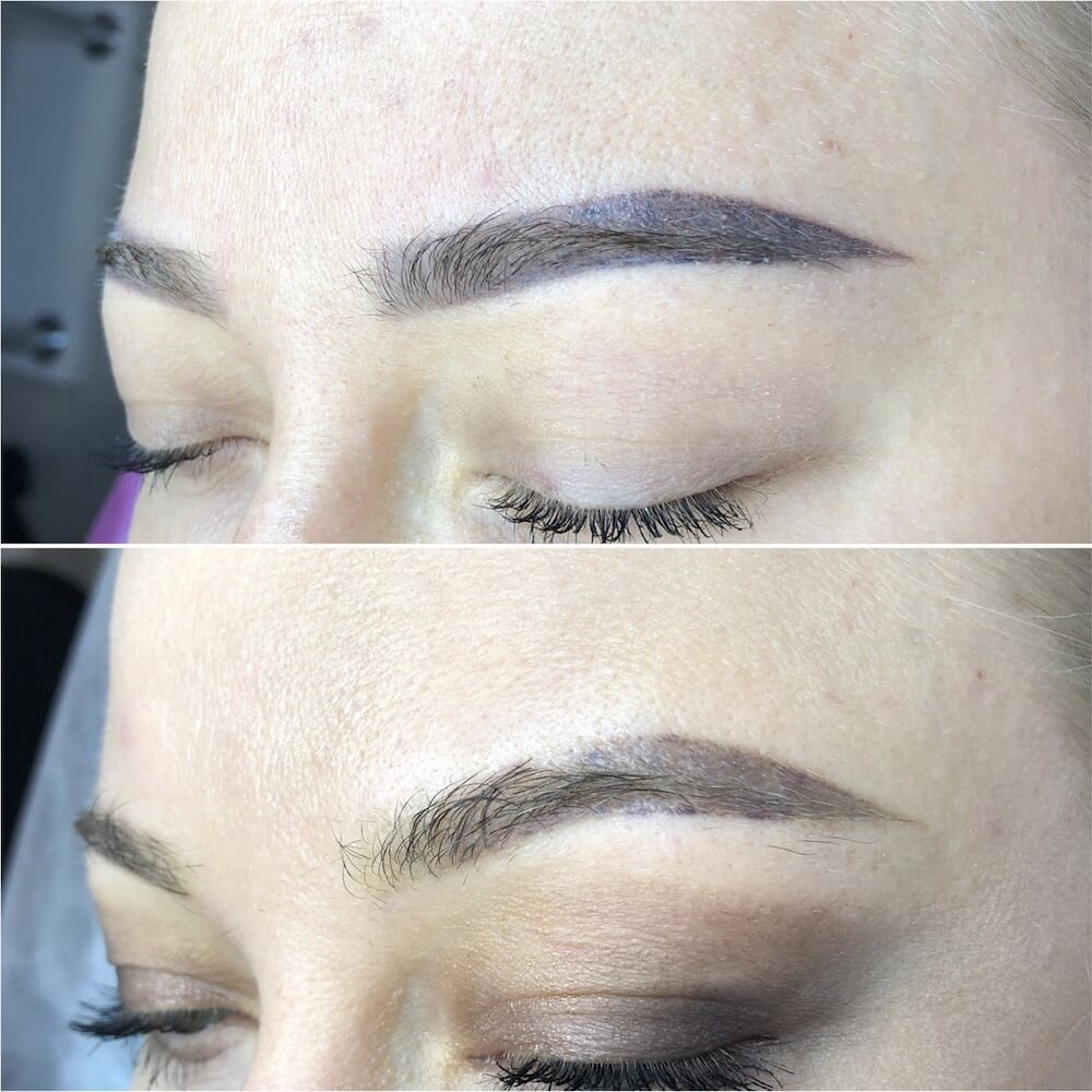 Laserowe usuwanie makijażu permanentnego