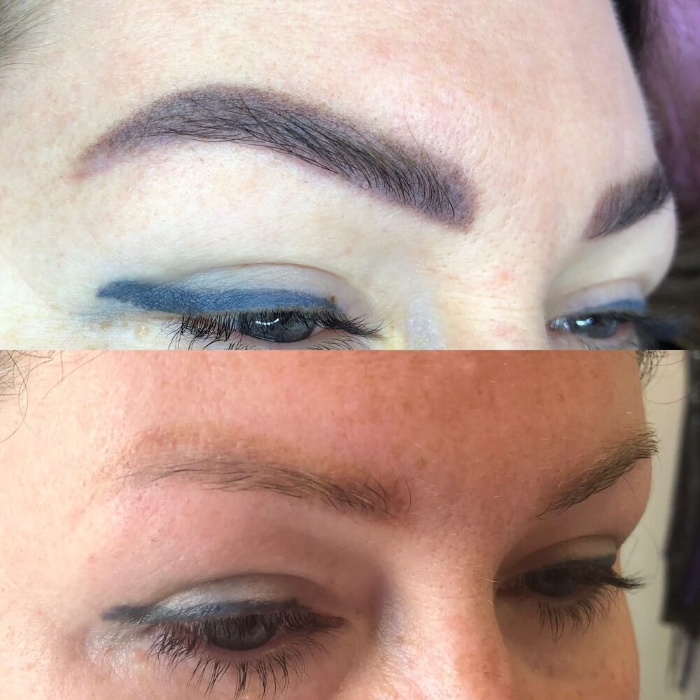 Laserowe usuwanie makijażu permanentnego