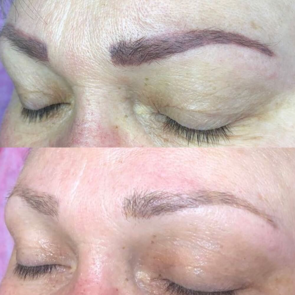 Laserowe usuwanie makijażu permanentnego